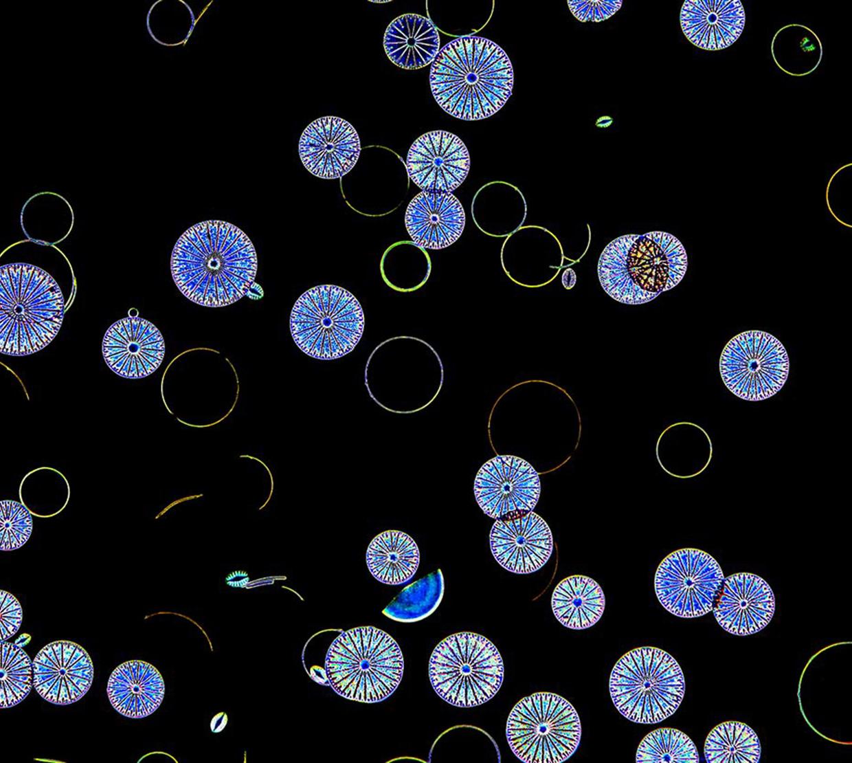 microscopic view of mating diatoms